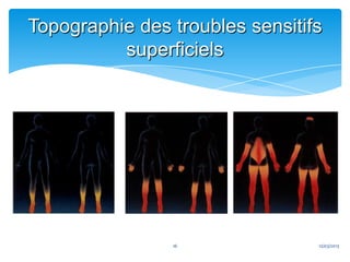 Topographie des troubles sensitifs
          superficiels




                16               12/03/2013
 