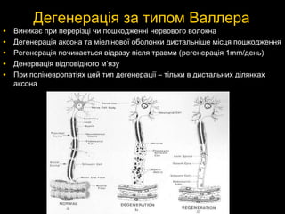 Дегенерація за типом ВаллераДегенерація за типом Валлера
• Виникає при перерізці чи пошкодженні нервового волокнаВиникає при перерізці чи пошкодженні нервового волокна
• Дегенерація аксона та міелінової оболонки дистальніше місця пошкодженняДегенерація аксона та міелінової оболонки дистальніше місця пошкодження
• Регенерація починається відразу після травми (Регенерація починається відразу після травми (регенераціярегенерація 1mm/1mm/день)день)
• Денервація відповідного мДенервація відповідного м’’язуязу
• При поліневропатіях цей тип дегенерації – тільки в дистальних ділянкахПри поліневропатіях цей тип дегенерації – тільки в дистальних ділянках
аксонааксона
 