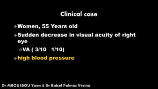 Polypoidal choroidal vasculopathy (pcv)