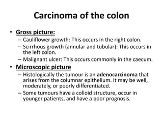Carcinoma of the colon
• Gross picture:
– Cauliflower growth: This occurs in the right colon.
– Scirrhous growth (annular and tubular): This occurs in
the left colon.
– Malignant ulcer: This occurs commonly in the caecum.
• Microscopic picture
– Histologically the tumour is an adenocarcinoma that
arises from the columnar epithelium. It may be well,
moderately, or poorly differentiated.
– Some tumours have a colloid structure, occur in
younger patients, and have a poor prognosis.
 