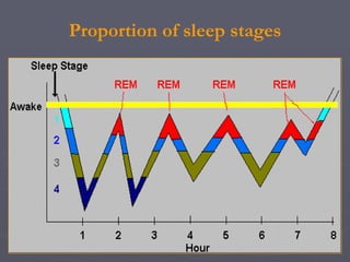 Polysomnography: recording and sleep staging | PPT