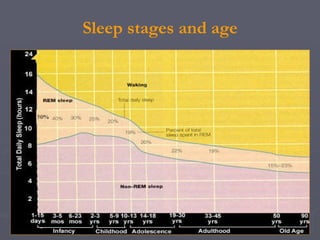 Polysomnography: recording and sleep staging | PPT