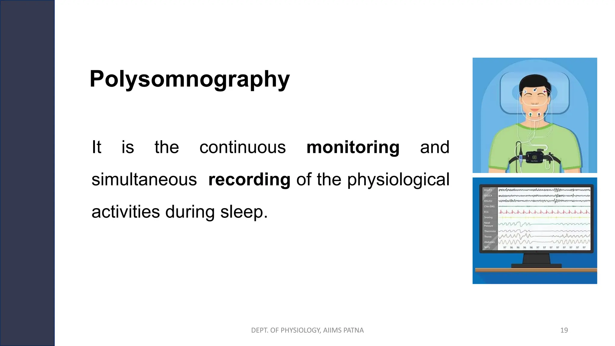 Polysomnography
It is the continuous monitoring and
simultaneous recording of the physiological
activities during sleep.
DEPT. OF PHYSIOLOGY, AIIMS PATNA 19
 