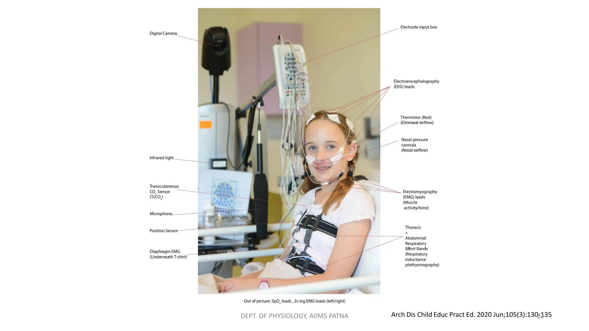 Arch Dis Child Educ Pract Ed. 2020 Jun;105(3):130-135
DEPT. OF PHYSIOLOGY, AIIMS PATNA 32
 