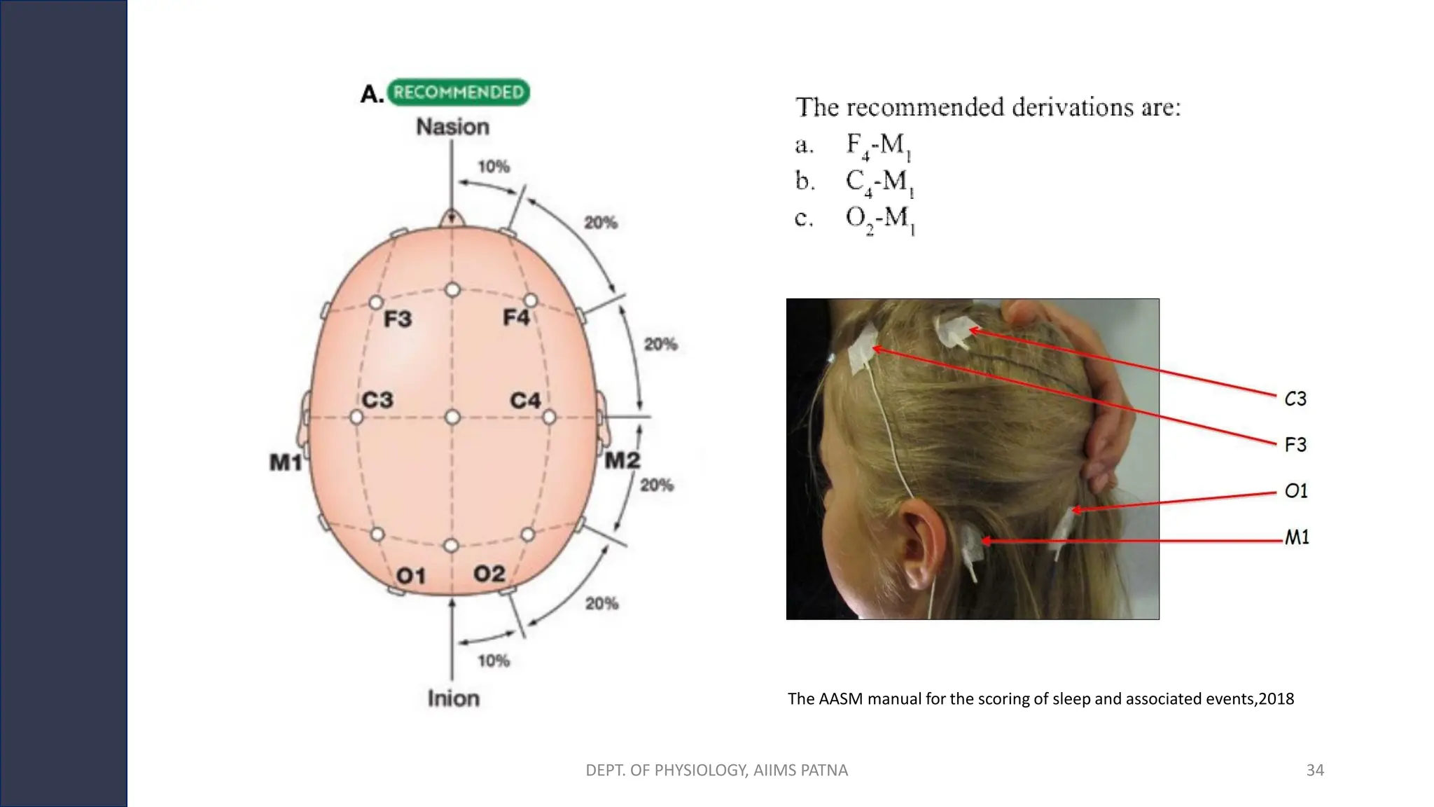 The AASM manual for the scoring of sleep and associated events,2018
DEPT. OF PHYSIOLOGY, AIIMS PATNA 34
 