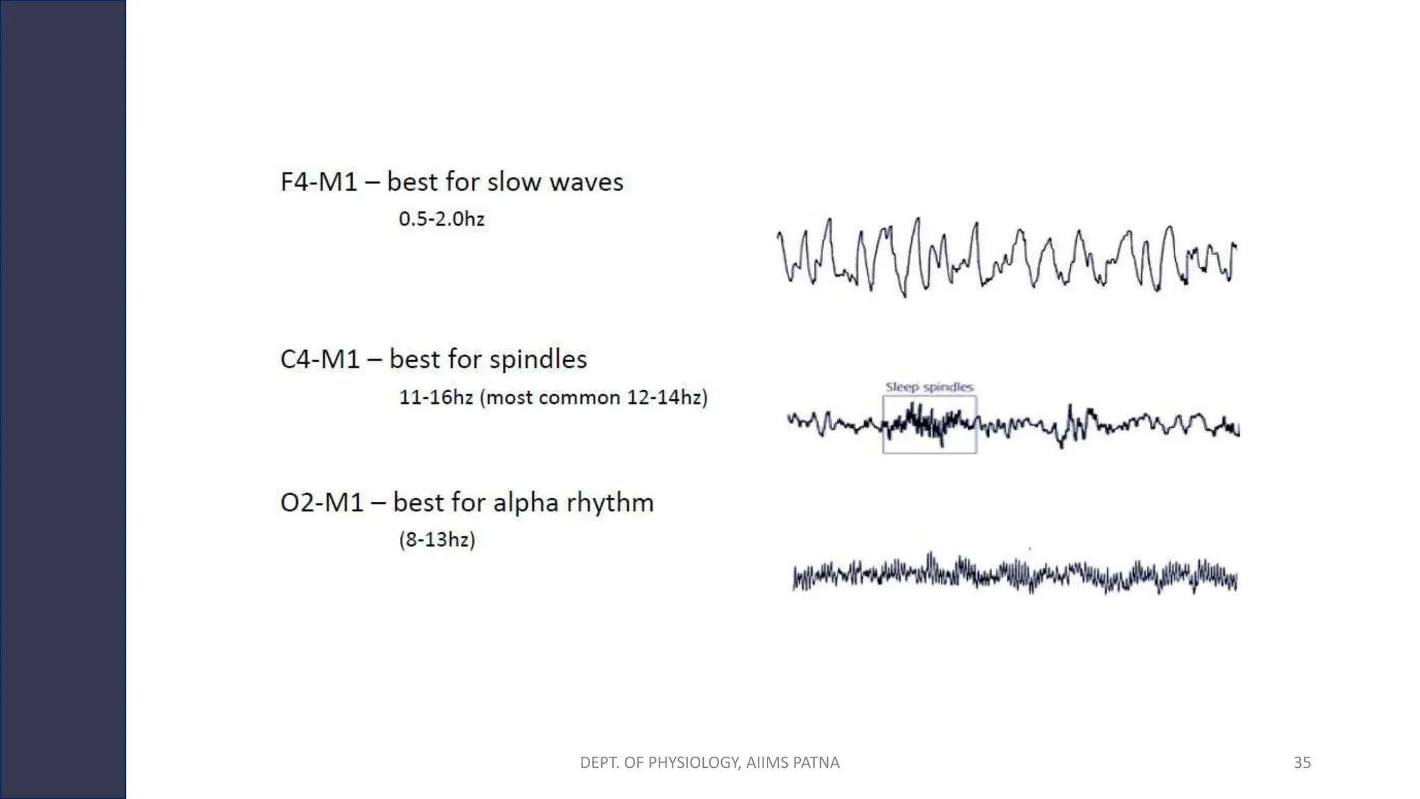 DEPT. OF PHYSIOLOGY, AIIMS PATNA 35
 