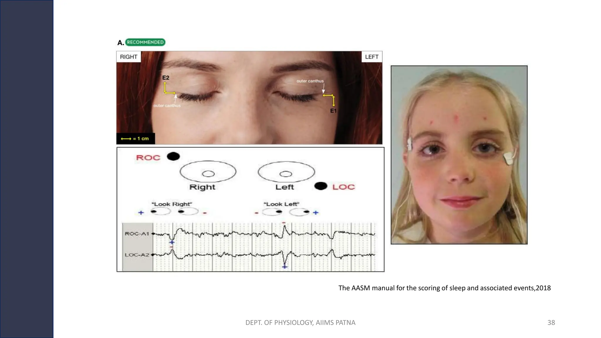 The AASM manual for the scoring of sleep and associated events,2018
DEPT. OF PHYSIOLOGY, AIIMS PATNA 38
 