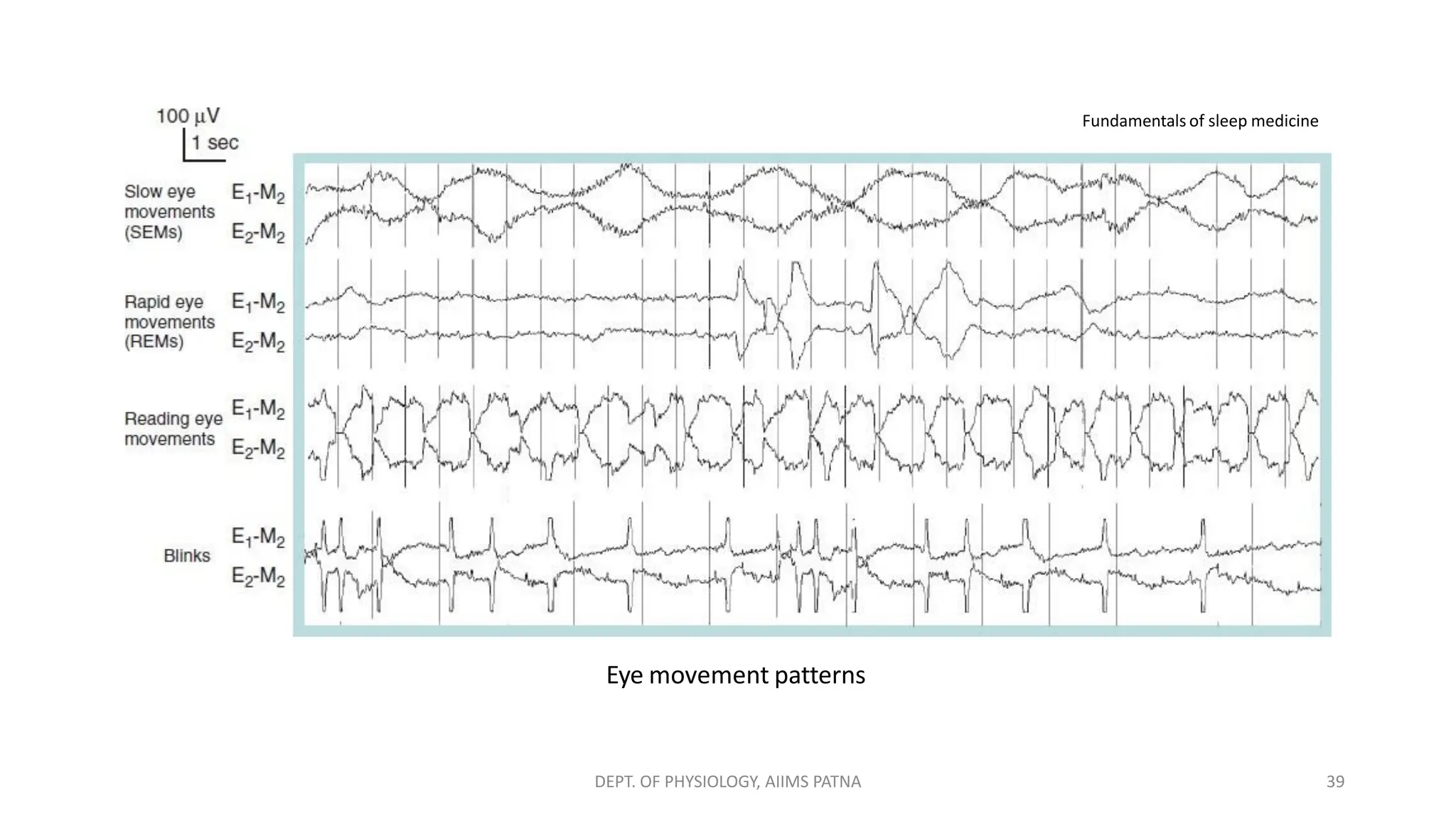 Eye movement patterns
Fundamentals of sleep medicine
DEPT. OF PHYSIOLOGY, AIIMS PATNA 39
 