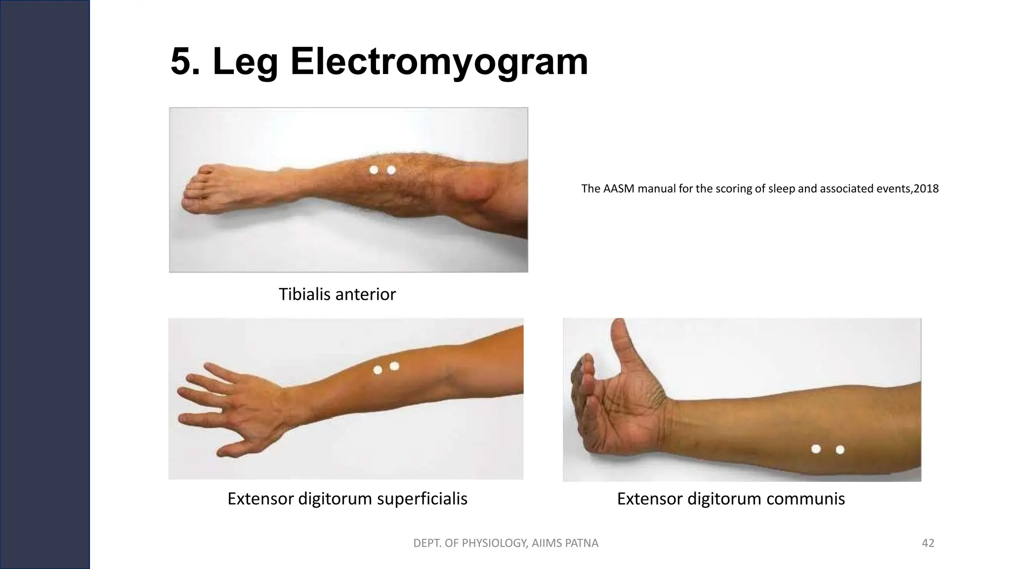 5. Leg Electromyogram
Tibialis anterior
The AASM manual for the scoring of sleep and associated events,2018
Extensor digitorum superficialis Extensor digitorum communis
DEPT. OF PHYSIOLOGY, AIIMS PATNA 42
 