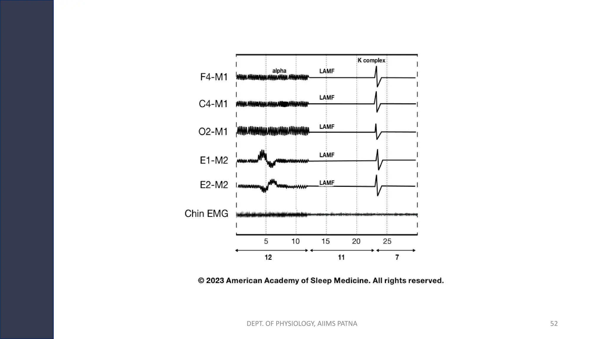 DEPT. OF PHYSIOLOGY, AIIMS PATNA 52
 