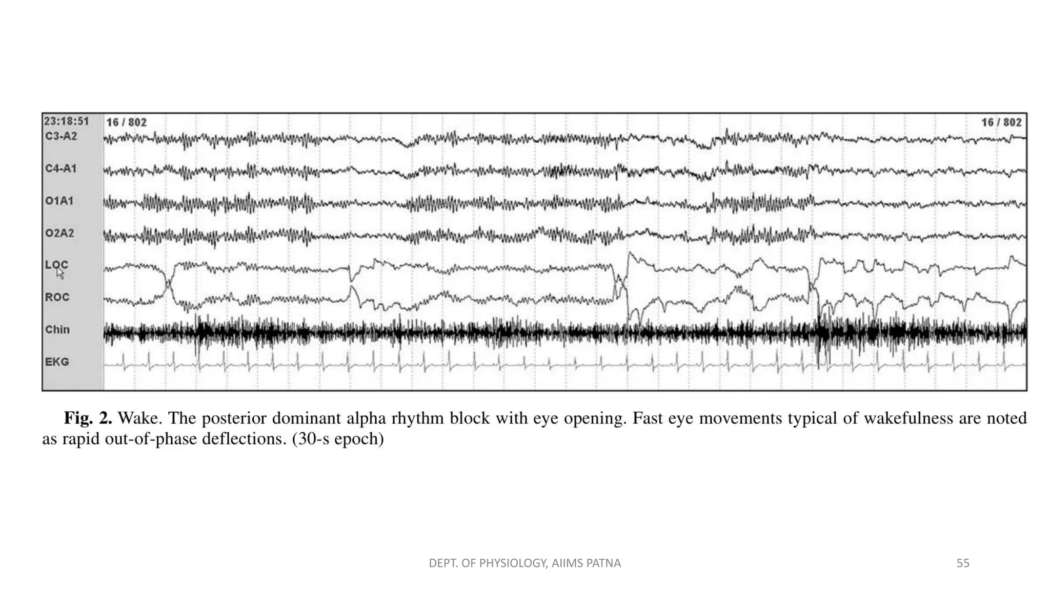 DEPT. OF PHYSIOLOGY, AIIMS PATNA 55
 