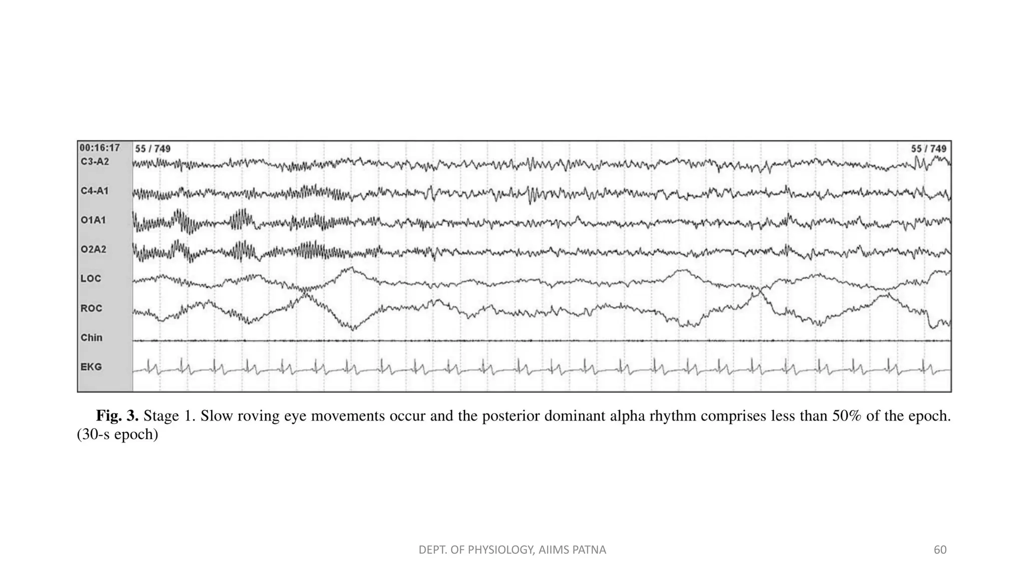 DEPT. OF PHYSIOLOGY, AIIMS PATNA 60
 