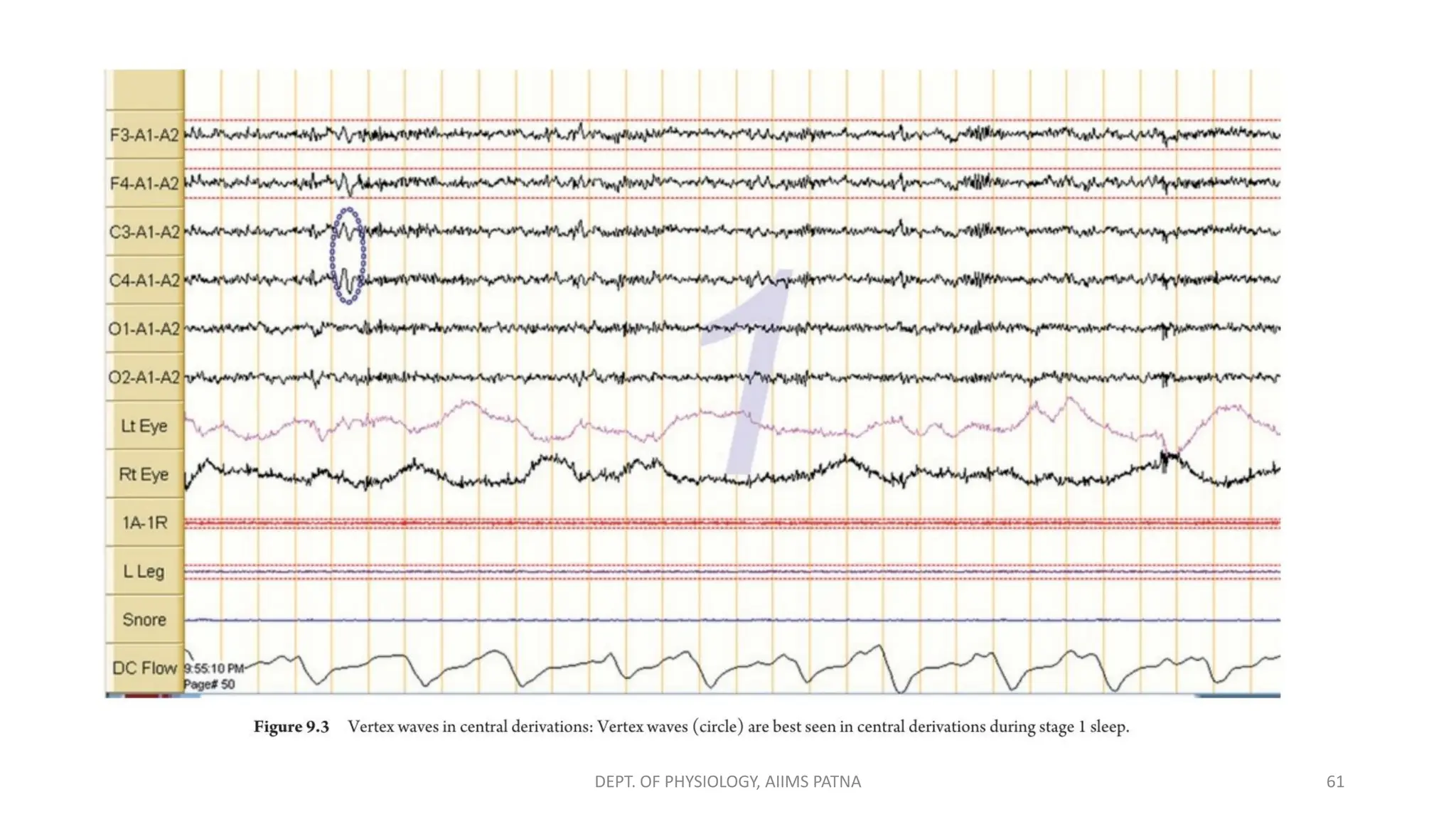 DEPT. OF PHYSIOLOGY, AIIMS PATNA 61
 