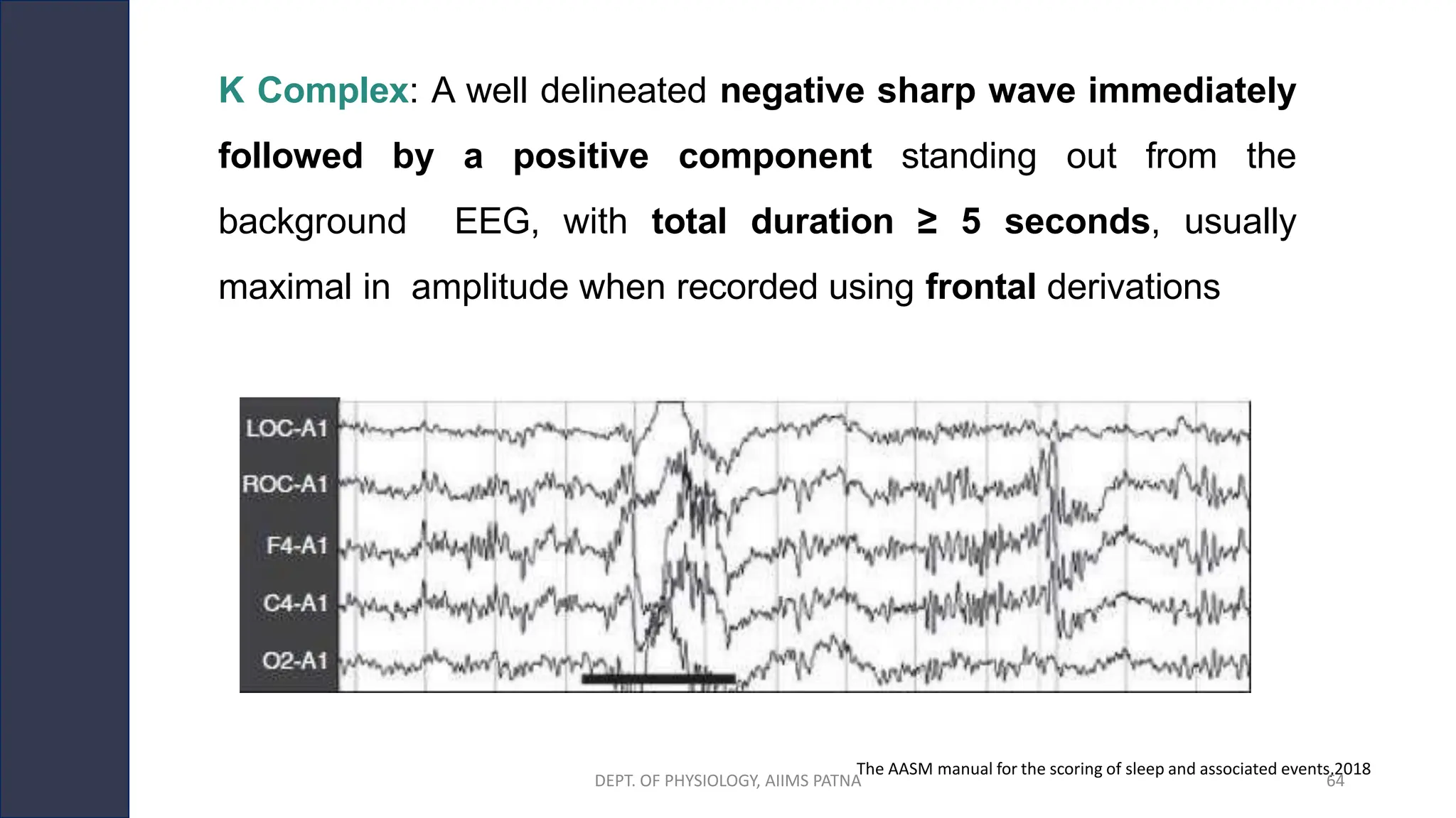 K Complex: A well delineated negative sharp wave immediately
followed by a positive component standing out from the
background EEG, with total duration ≥ 5 seconds, usually
maximal in amplitude when recorded using frontal derivations
The AASM manual for the scoring of sleep and associated events,2018
DEPT. OF PHYSIOLOGY, AIIMS PATNA 64
 