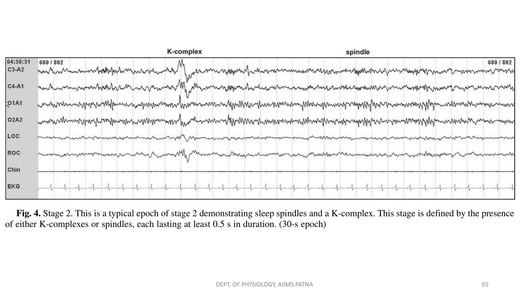 DEPT. OF PHYSIOLOGY, AIIMS PATNA 65
 