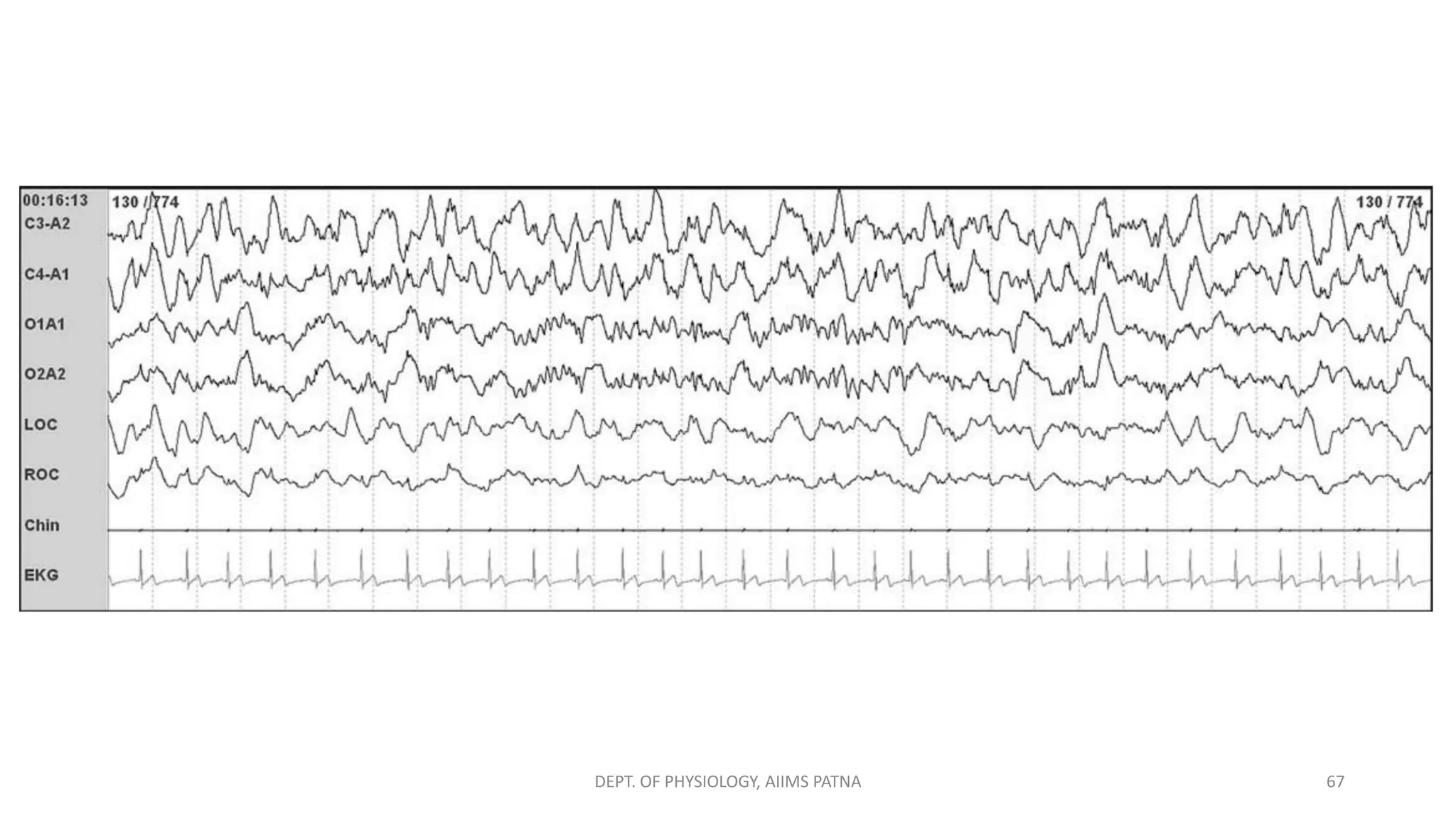 DEPT. OF PHYSIOLOGY, AIIMS PATNA 67
 