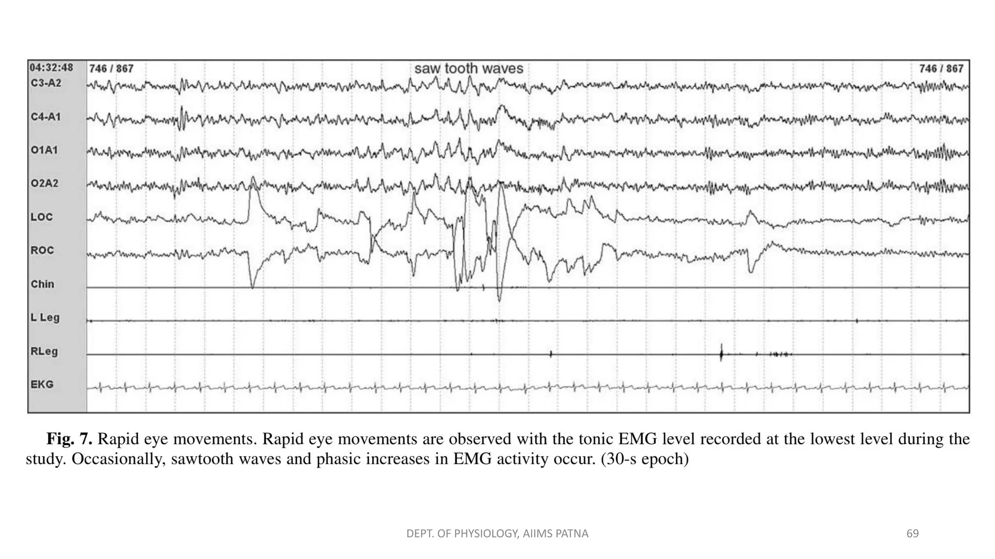 DEPT. OF PHYSIOLOGY, AIIMS PATNA 69
 
