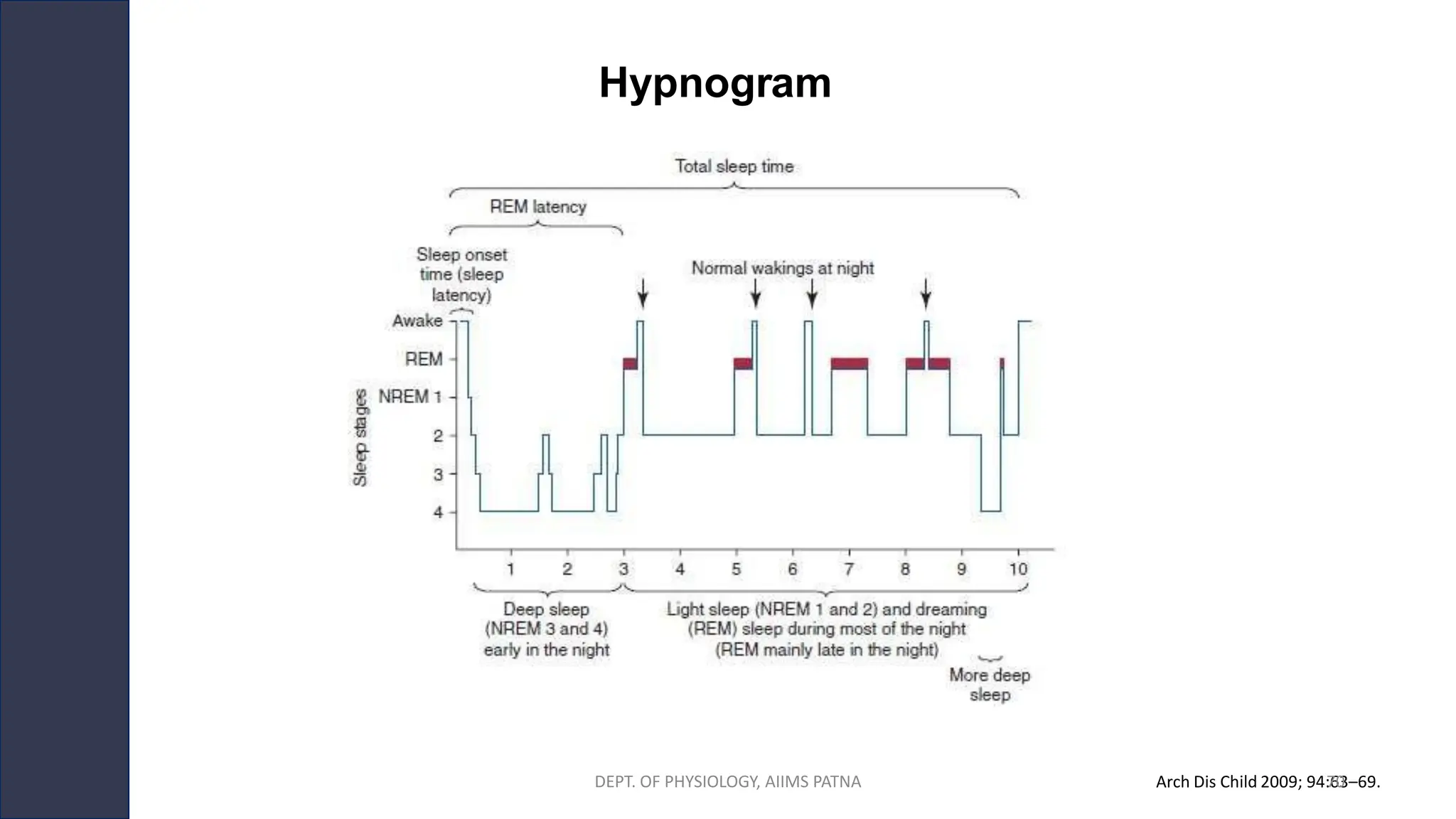 Arch Dis Child 2009; 94:63–69.
DEPT. OF PHYSIOLOGY, AIIMS PATNA 70
Hypnogram
 