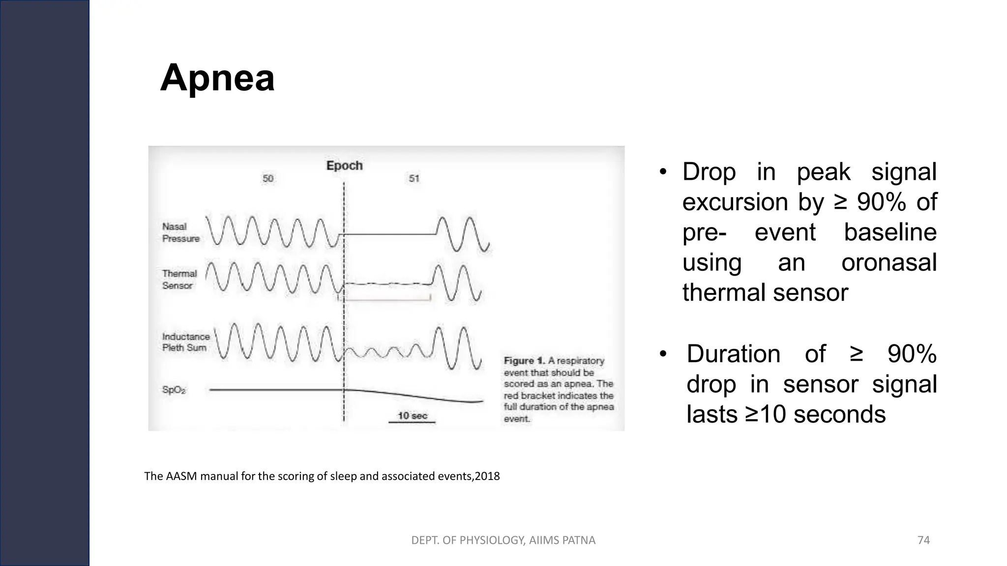 Apnea
• Drop in peak signal
excursion by ≥ 90% of
pre- event baseline
using an oronasal
thermal sensor
• Duration of ≥ 90%
drop in sensor signal
lasts ≥10 seconds
The AASM manual for the scoring of sleep and associated events,2018
DEPT. OF PHYSIOLOGY, AIIMS PATNA 74
 
