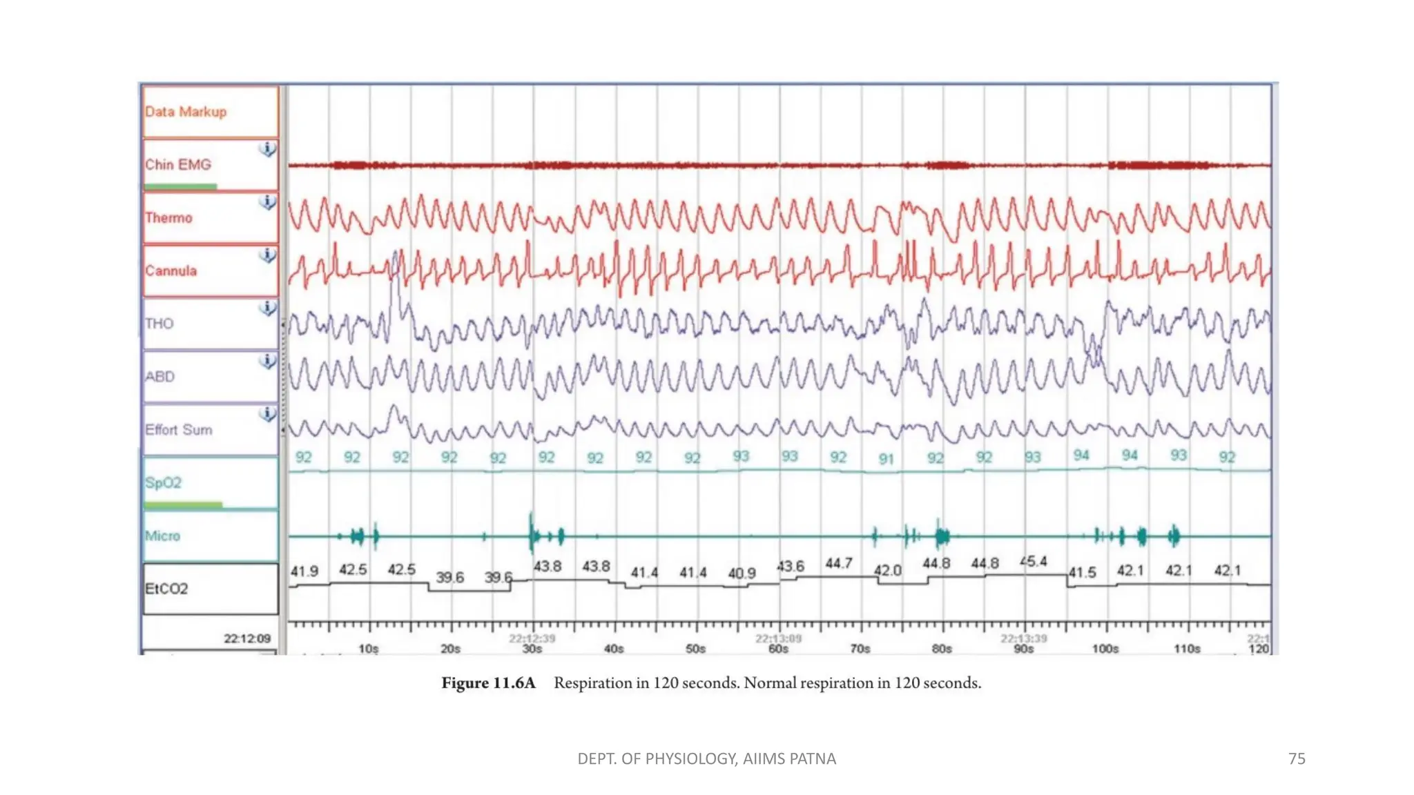 DEPT. OF PHYSIOLOGY, AIIMS PATNA 75
 