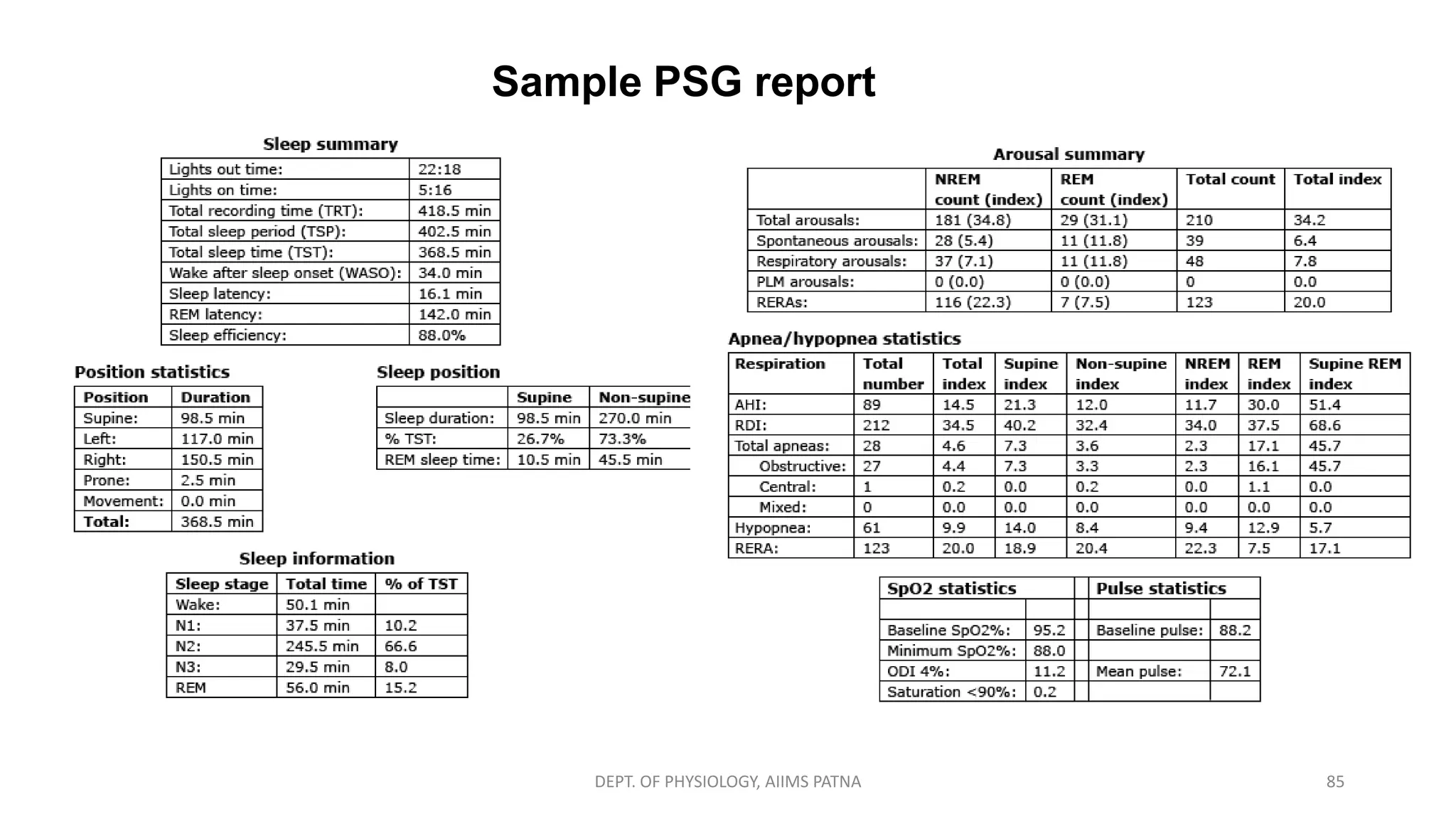 Sample PSG report
DEPT. OF PHYSIOLOGY, AIIMS PATNA 85
 