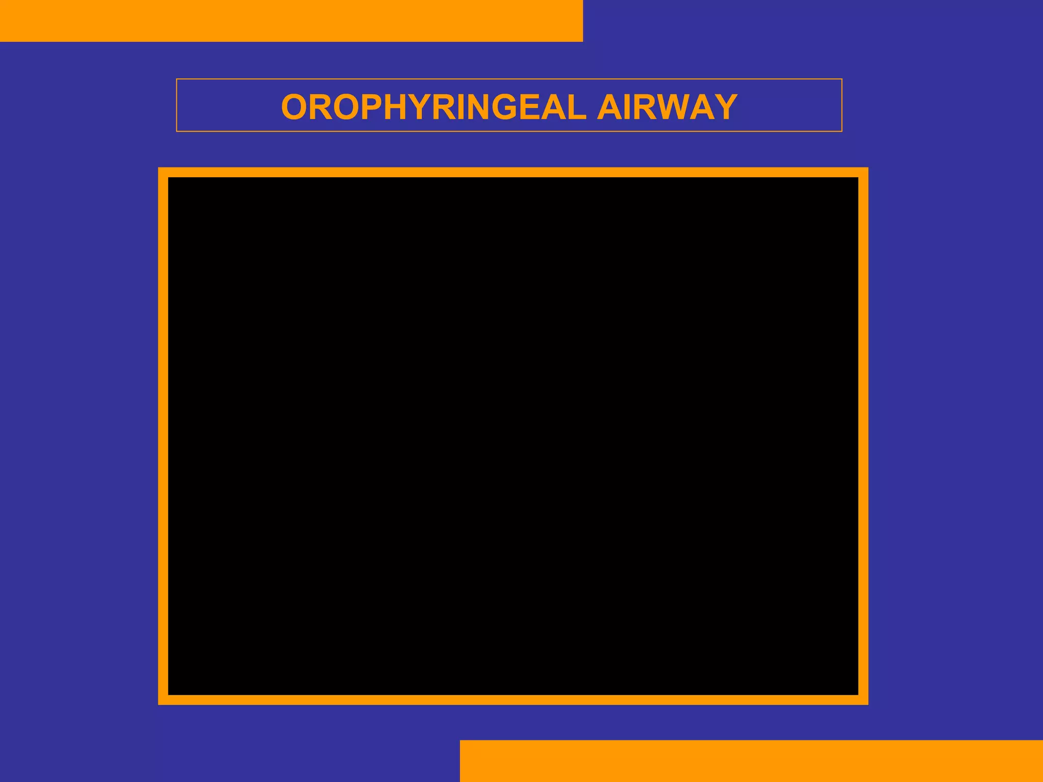 OROPHYRINGEAL AIRWAY 