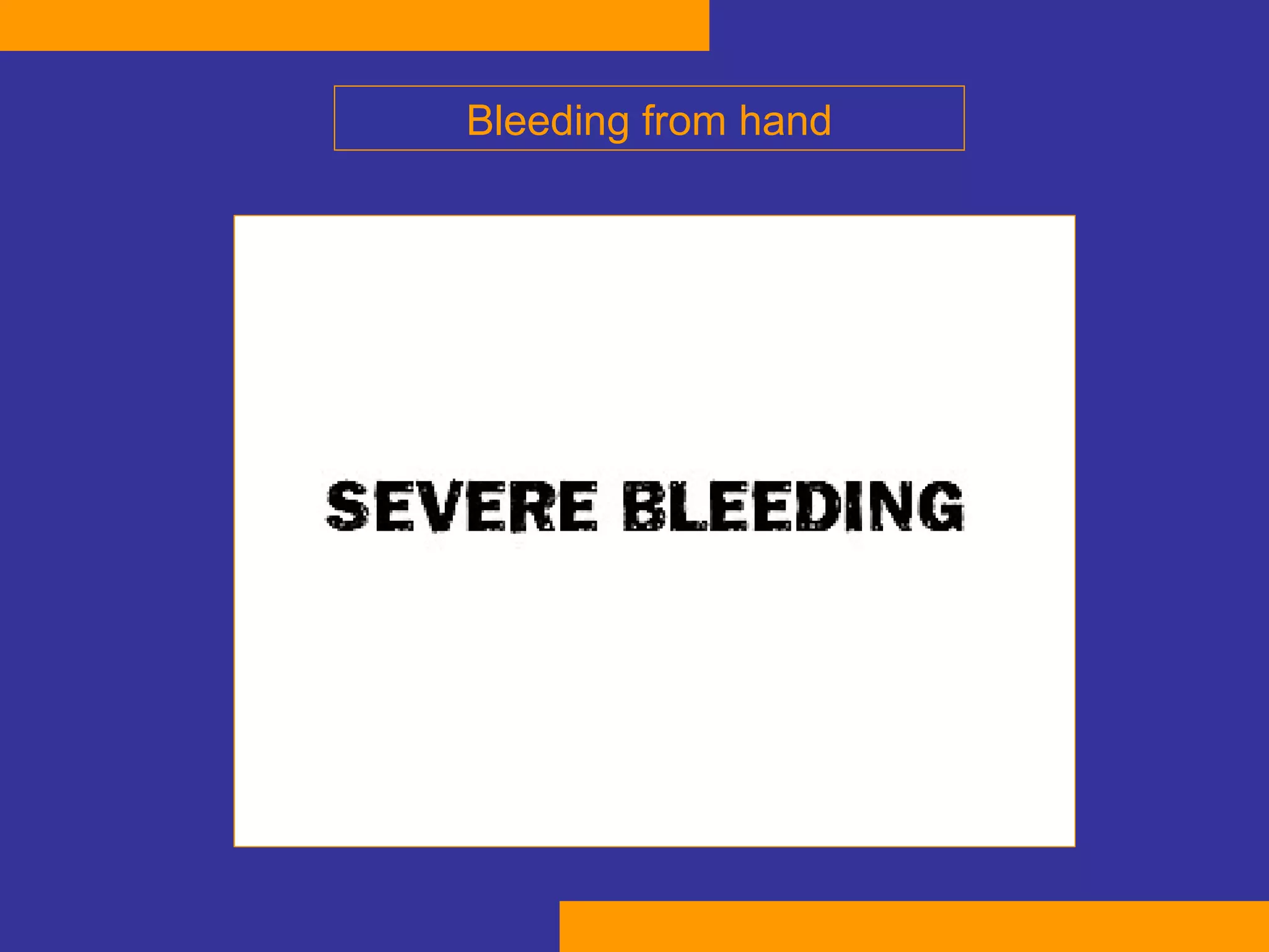 Bleeding from hand 