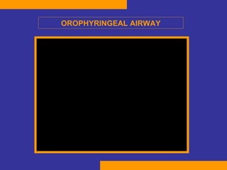 OROPHYRINGEAL AIRWAY 