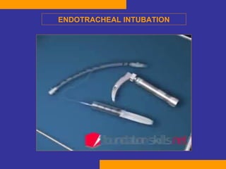 ENDOTRACHEAL INTUBATION 
