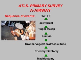 ATLS- PRIMARY SURVEY
A-AIRWAY
Sequence of events: chin lift
Jaw thrust
finger sweep
suction
Oropharyngeal/ orotrachial tube
Cricothyroidotomy
Trachiostomy
 