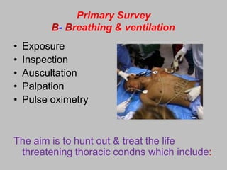 Primary Survey
B- Breathing & ventilation
• Exposure
• Inspection
• Auscultation
• Palpation
• Pulse oximetry
The aim is to hunt out & treat the life
threatening thoracic condns which include:
 