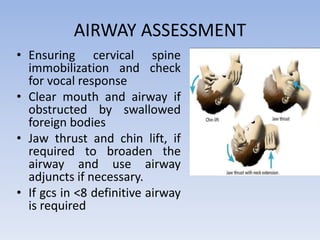 AIRWAY ASSESSMENT
• Ensuring cervical spine
immobilization and check
for vocal response
• Clear mouth and airway if
obstructed by swallowed
foreign bodies
• Jaw thrust and chin lift, if
required to broaden the
airway and use airway
adjuncts if necessary.
• If gcs in <8 definitive airway
is required
 