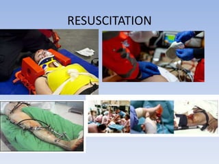 RESUSCITATION
 