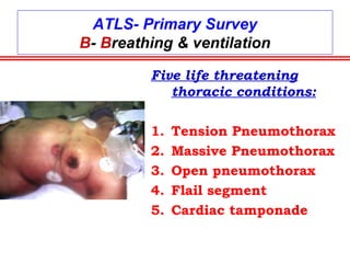 ATLS- PRIMARY SURVEY
A-AIRWAY
Sequence of events: chin lift
Jaw thrust
finger sweep
suction
Oropharyngeal/ orotrachial tube
Cricothyroidotomy
Trachiostomy
 