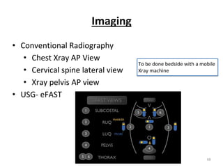 Imaging
• Conventional Radiography
• Chest Xray AP View
• Cervical spine lateral view
• Xray pelvis AP view
• USG- eFAST
To be done bedside with a mobile
Xray machine
68
 