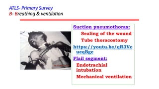 ATLS polytrauma_Final Mangement ASI 2.ppt