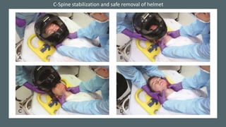 C-Spine stabilization and safe removal of helmet
 