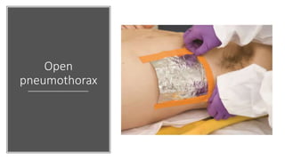 Open
pneumothorax
 