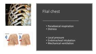 Flial chest
• Paradoxical respiration
• Distress
• Local pressure
• Endotracheal intubation
• Mechanical ventilation
 