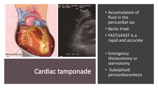 • Accumulation of
fluid in the
pericardial sac
• Becks triad
• FAST/eFAST is a
rapid and accurate
• Emergency
thoracotomy or
sternotomy
• Subxiphoid
pericardiocentesis
 