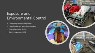 Exposure and
Environmental Control
• Completely undress the patient
• Cover the patient with warm blankets
• External warming device
• Warm intravenous fluid
 