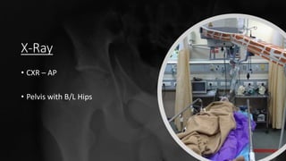 X-Ray
• CXR – AP
• Pelvis with B/L Hips
 