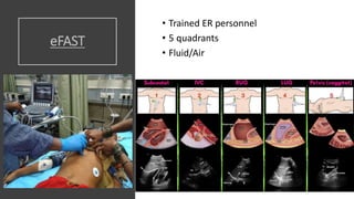 eFAST
• Trained ER personnel
• 5 quadrants
• Fluid/Air
 