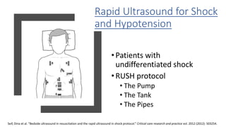 Rapid Ultrasound for Shock
and Hypotension
•Patients with
undifferentiated shock
•RUSH protocol
• The Pump
• The Tank
• The Pipes
Seif, Dina et al. “Bedside ultrasound in resuscitation and the rapid ultrasound in shock protocol.” Critical care research and practice vol. 2012 (2012): 503254.
 