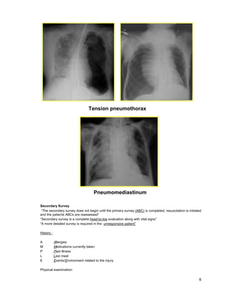 8
Secondary Survey
“The secondary survey does not begin until the primary survey (ABC) is completed, resuscitation is initiated
and the patients ABCs are reassessed”
“Secondary survey is a complete head-to-toe evaluation along with vital signs”
“A more detailed survey is required in the unresponsive patient”
History :
A Allergies
M Medications currently taken
P Past illness
L Last meal
E Events/Environment related to the injury
Physical examination:
Tension pneumothorax
Pneumomediastinum
 