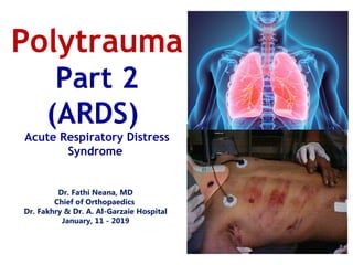 Dr. Fathi Neana, MD
Chief of Orthopaedics
Dr. Fakhry & Dr. A. Al-Garzaie Hospital
January, 11 - 2019
Polytrauma
Part 2
(ARDS)
Acute Respiratory Distress
Syndrome
 