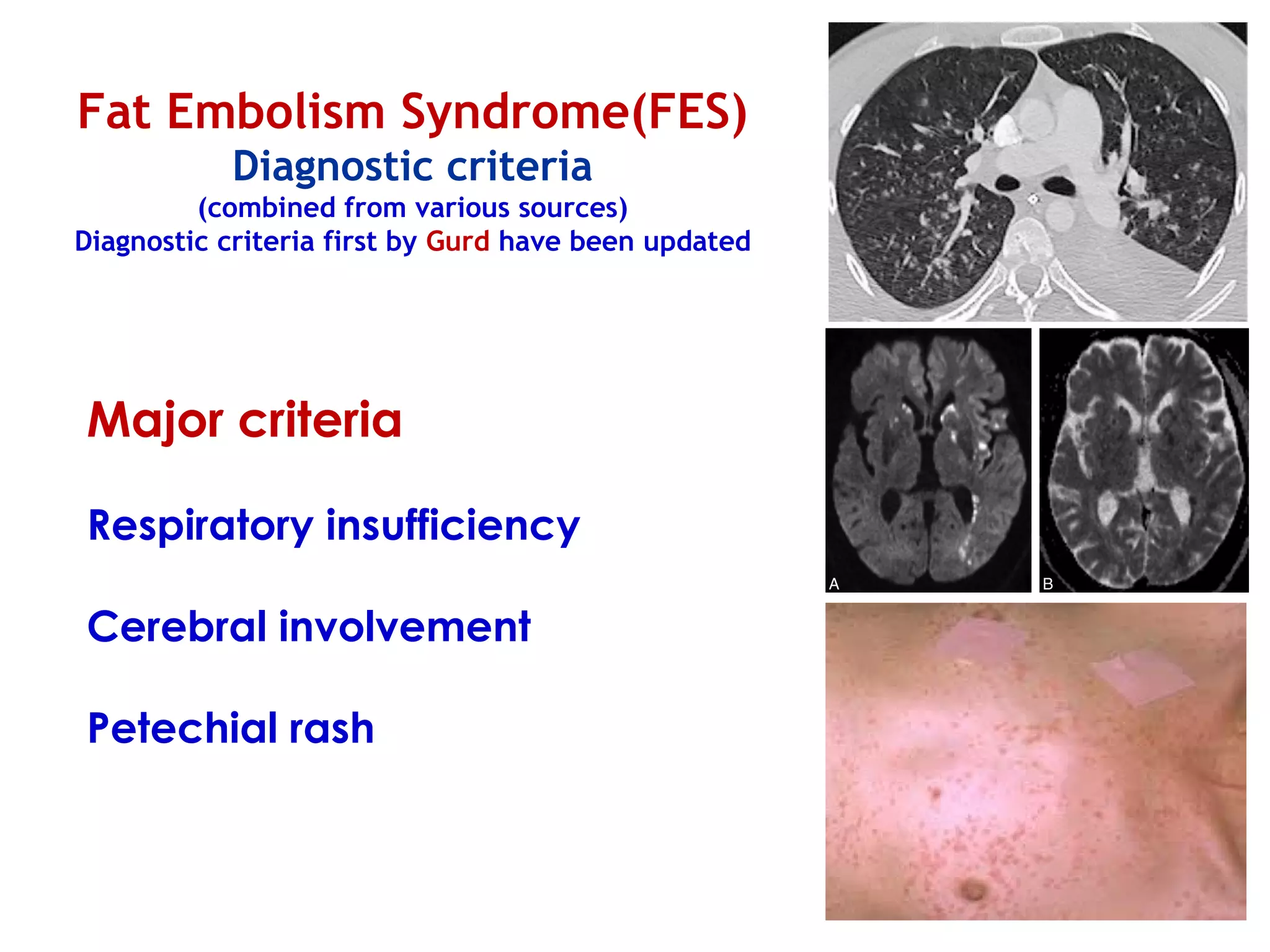 Embolic Rash Polytrauma part 3 (FES) | PPT | Lung and Respiratory Health | Diseases ...