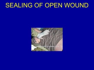 SEALING OF OPEN WOUND 
 