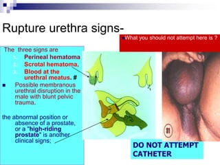High Riding Prostate Sign POLY TRAUMA Management strategies .ppt