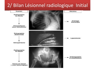 2/ Bilan Lésionnel radiologique Initial
 